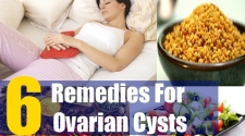 Ovarian Cysts