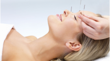 Everything You Need To Know About Acupuncture