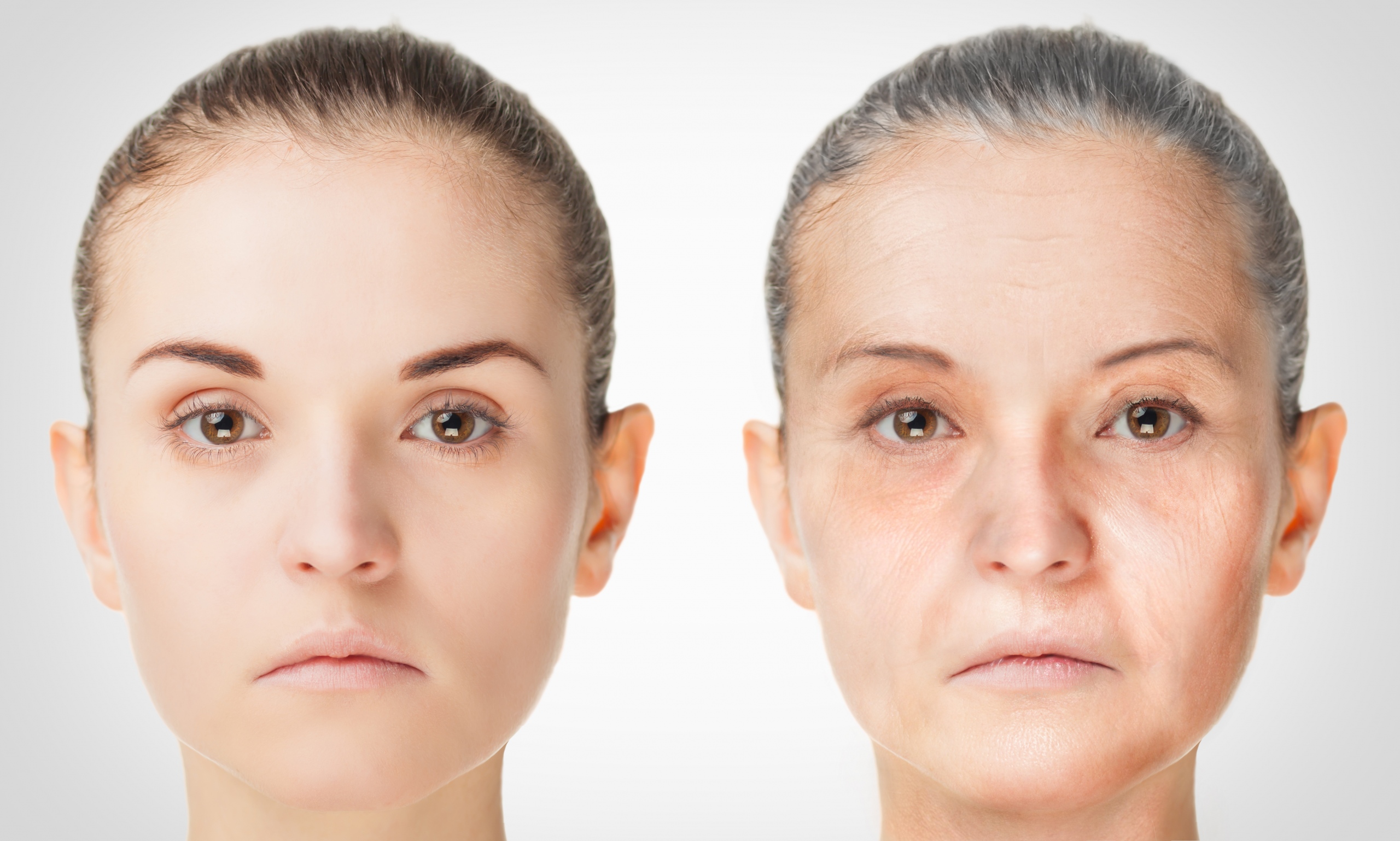 Anti Aging Creams - What To Consider Before You Purchase?