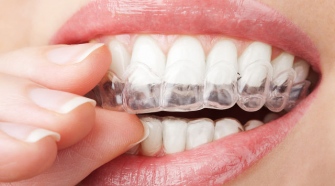 The Complete Beginner's Guide To Teeth Whitening Trays