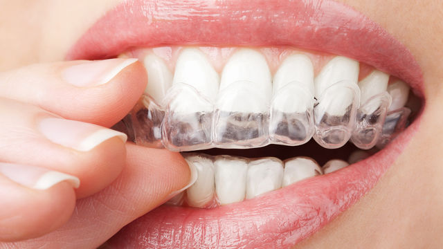 The Complete Beginner's Guide To Teeth Whitening Trays