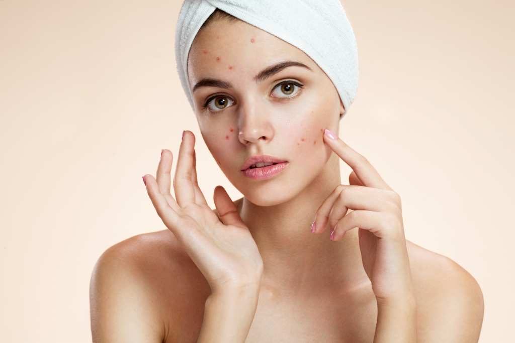 Get Rid Of Acne Scars: The Best Products For You