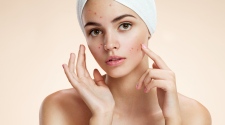 Get Rid Of Acne Scars: The Best Products For You
