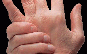 What Causes Arthritis