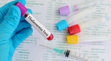 Understanding All About Thalassemia Treatment