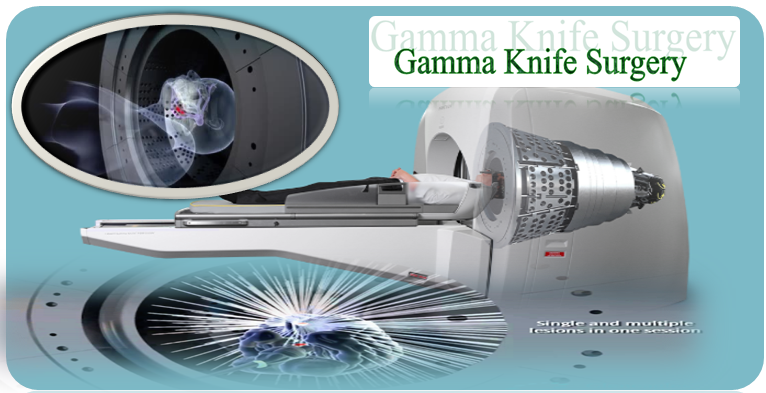 Gamma Knife Surgery
