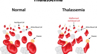 Types Of Thalassemia and Their Causes